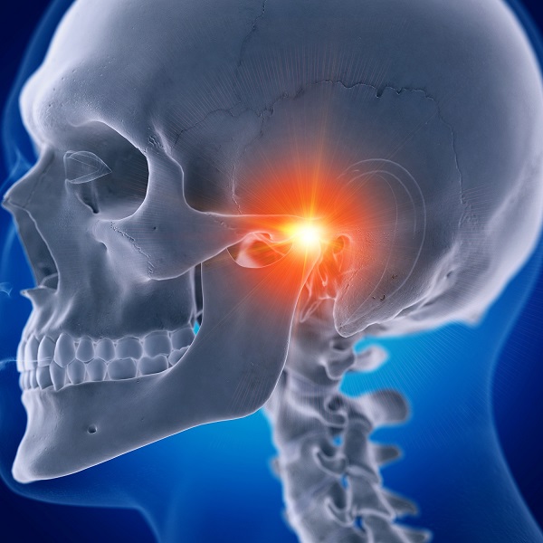 Illustration of TMJ pain caused by temporomandibular joint disorder