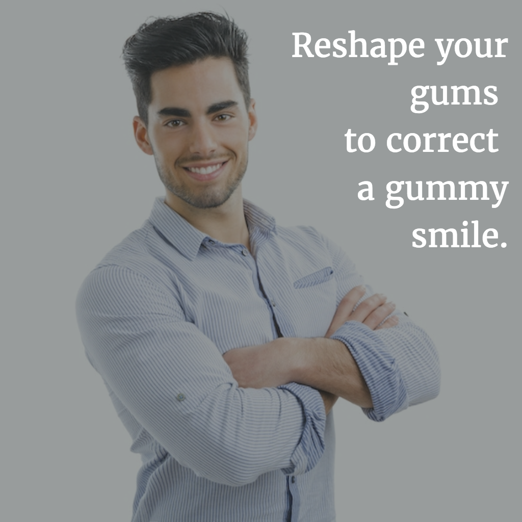 Gum Contouring to Correct Gummy Smile | Denver CO