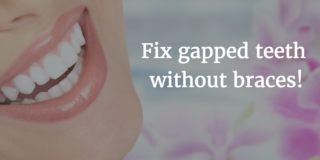 Fix Gapped Teeth - Cosmetic Dentist Dr. Scott Greenhalgh