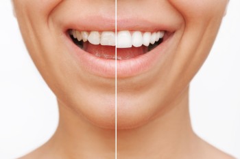 Dental Technology