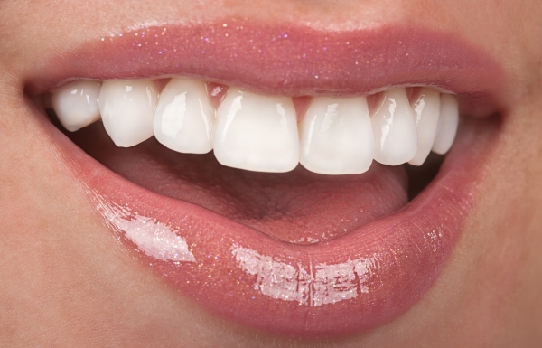 Woman Smiling After Teeth Whitening