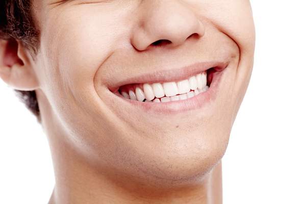 Porcelain Veneers Process | Lakewood, Colorado